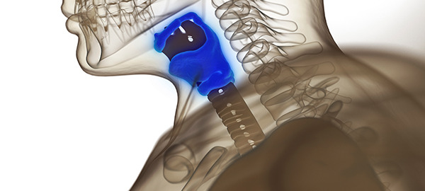 Hypothyroidism – A bigger problem than we think?