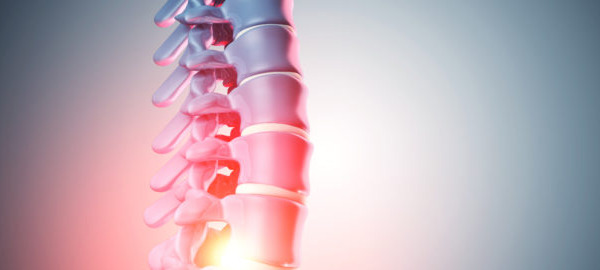 The case for diet as a contributor to non-specific chronic low back pain
