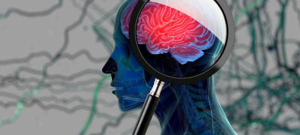 Nutritional Support for Parkinson’s Disease
