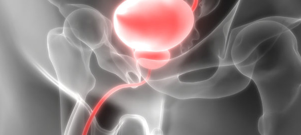 Benign prostate hyperplasia is on the increase – what is it and how may polyphenols help?