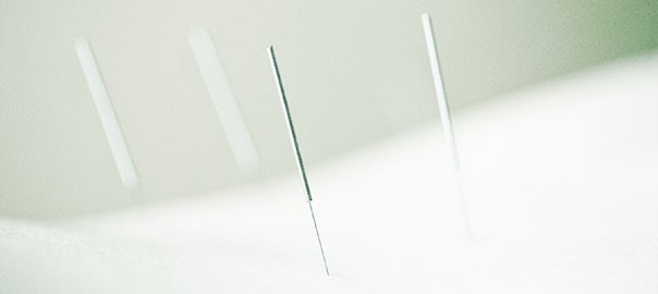What is Naturopathic Acupuncture?