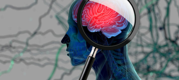 Nutritional Support for Parkinson’s Disease