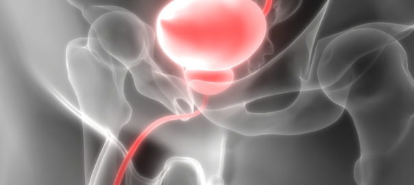Benign prostate hyperplasia is on the increase – what is it and how may polyphenols help?